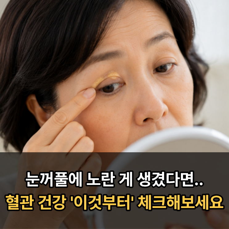  눈꺼풀에 노란 게 생겼다면.. 혈관 건강 '이것부터' 체크해보세요