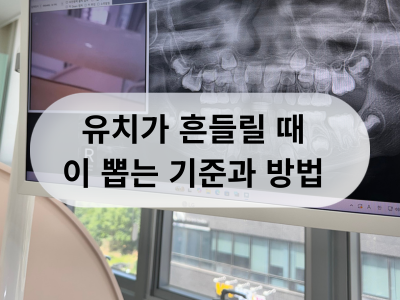 흔들리는 유치 집에서 뽑아도 될까? 치과를 가야 할까?