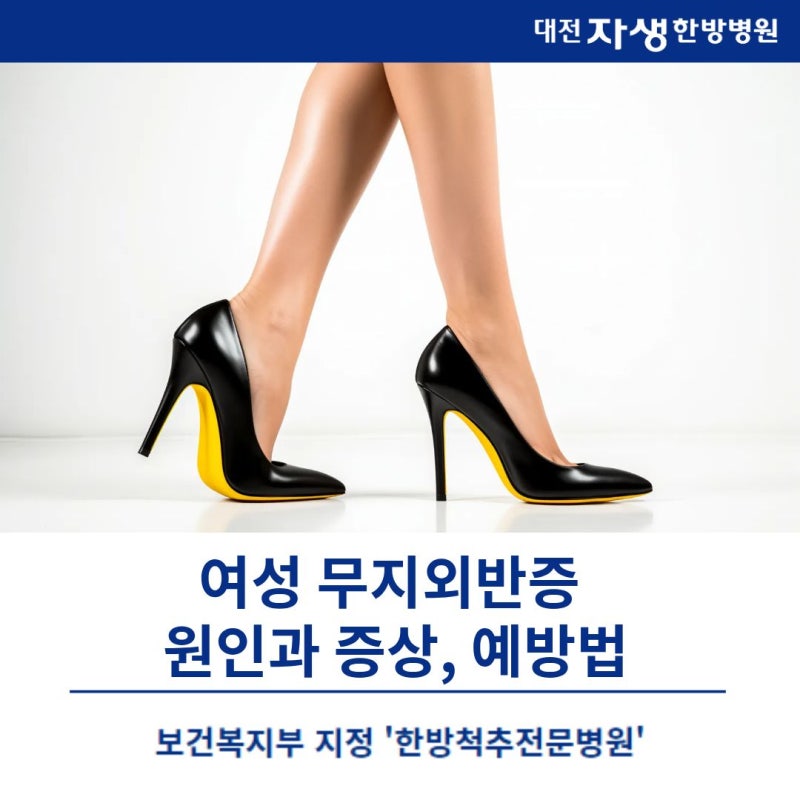 [대전무지외반증]대전자생한방병원, 여성 무지외반증 원인과 증상, 예방법까지 한눈에 정리