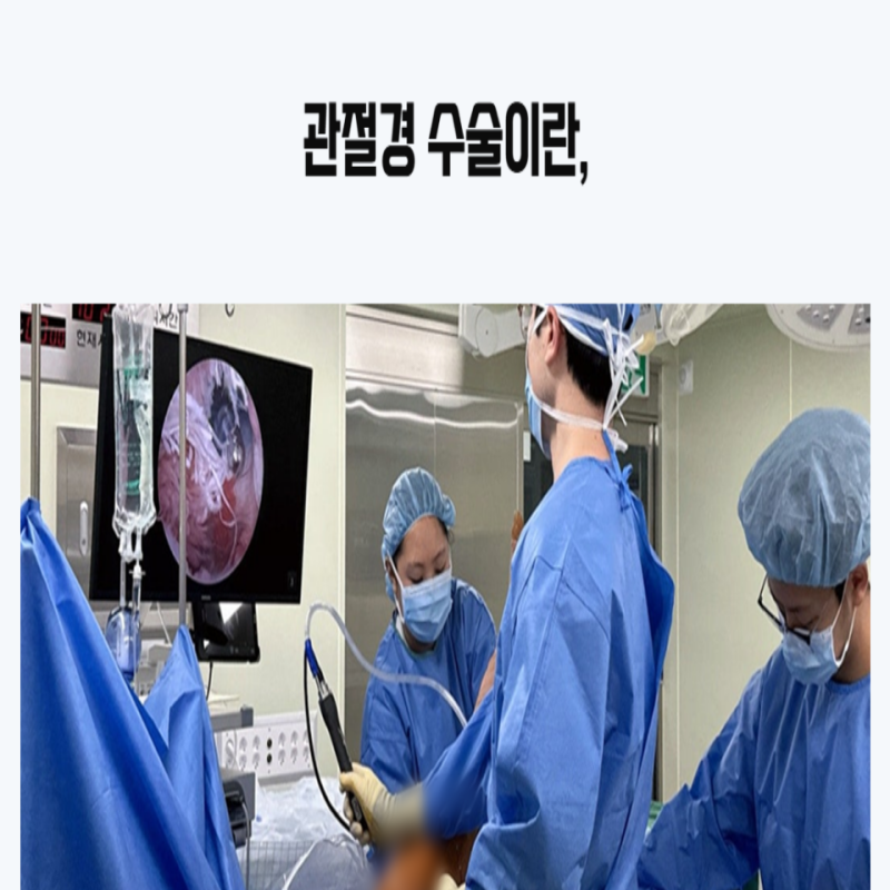 팔 올릴 때 찌릿한 어깨 통증 관절경수술 필요한 대상과 장점