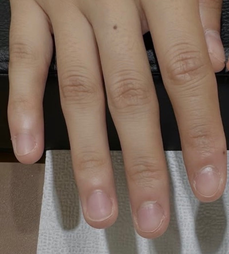 손톱 뜯는 버릇 고치려고 네일 연장한 후기｜짧은 손톱 교정 기록