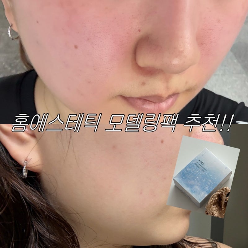 운동 후 열감 진정템 찾는다면!! 솔브 세럼 모델링팩 솔직 후기 (팩 추천)