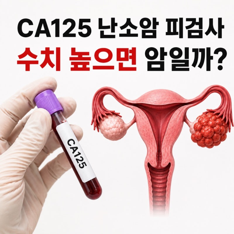 난소암 피검사 수치 높으면 무조건 위험할까? ( ca125 검사 비용 )