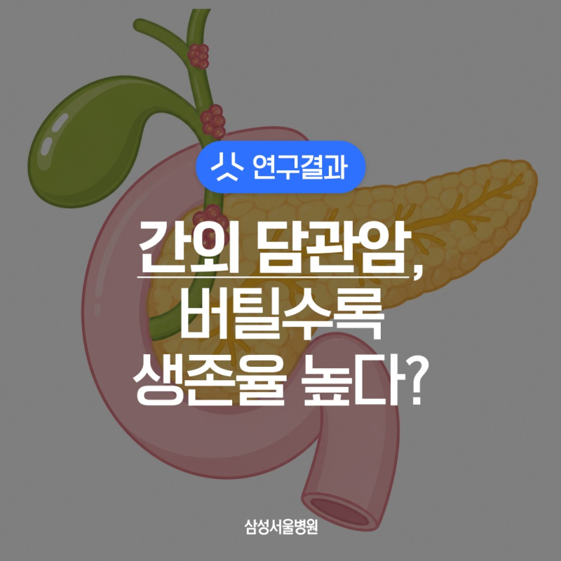 간외 담관암 수술 후 생존율과 재발 확률은? / 삼성서울병원 연구 결과