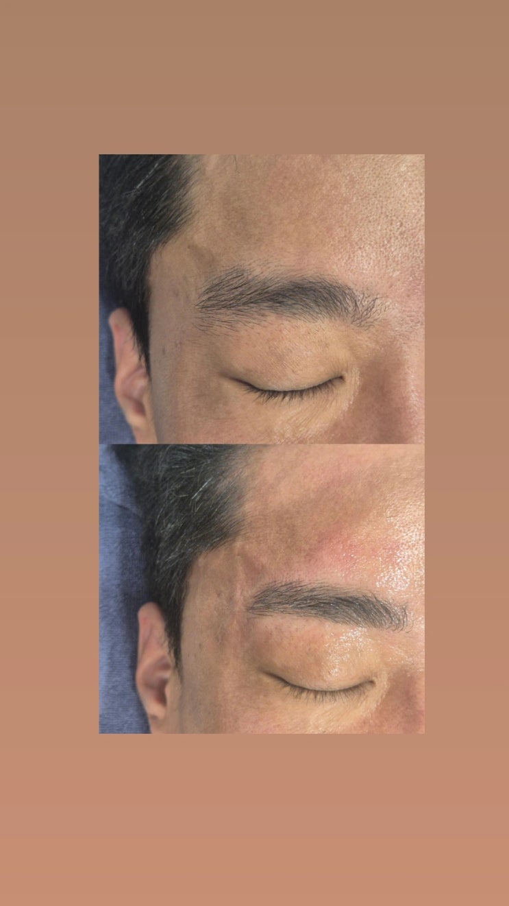  남자 눈썹 왁싱은 경험치가 풍부한 영등포 남자 왁싱샵 "청춘케어"에서