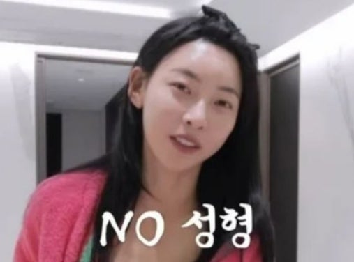 "성형은 하나도 안 했다" 나솔 아니고 솔로지옥5 김민지 시술 고백 전말