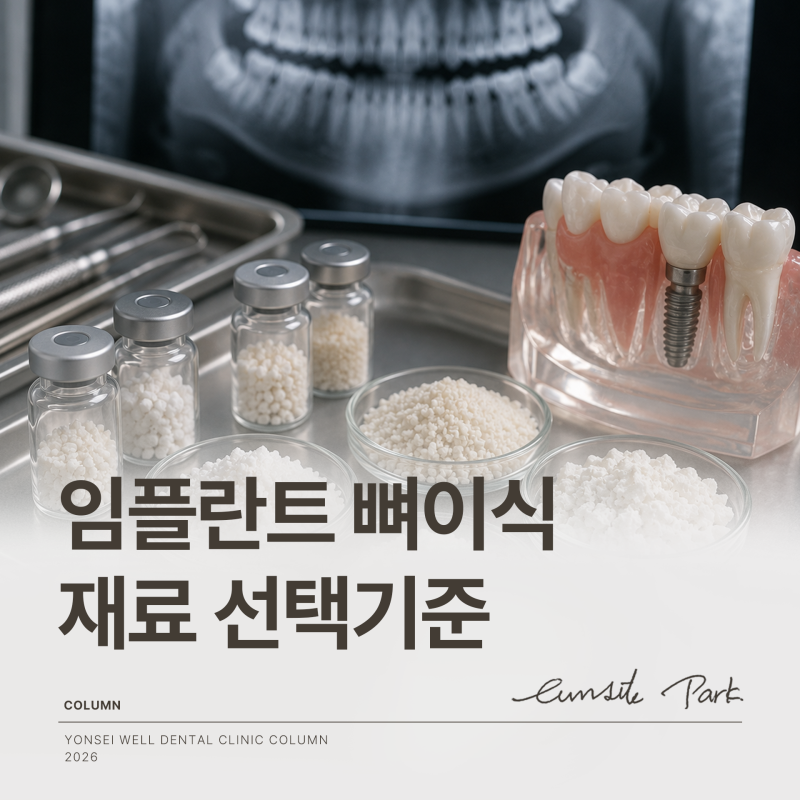 임플란트 뼈이식 재료, 어떤 기준으로 선택할까? 골이식재 종류
