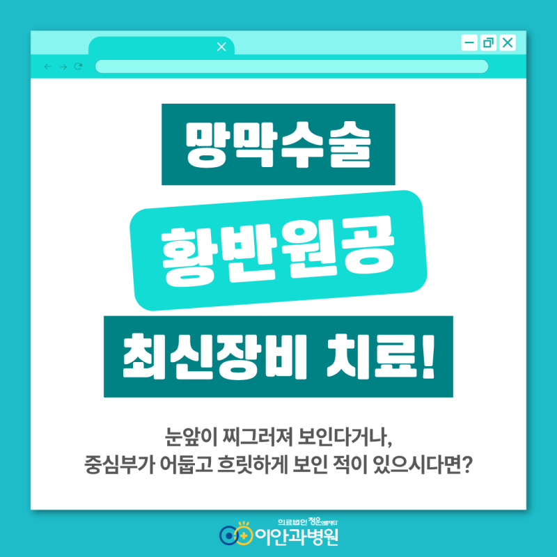 대전 망막수술 황반원공, 눈앞이 찌그러져 보인다면? 대전이안과병원에서 최신장비로 안전....