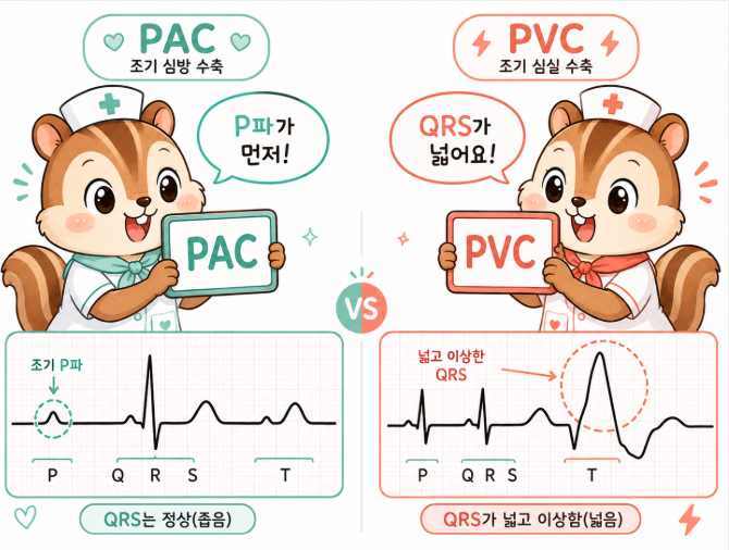 [EKG 6탄] 기타 부정맥 완벽 정리: PAC, PVC, Torsades, PEA, Asystole 쉽게 구분하고 빠르게 ...
