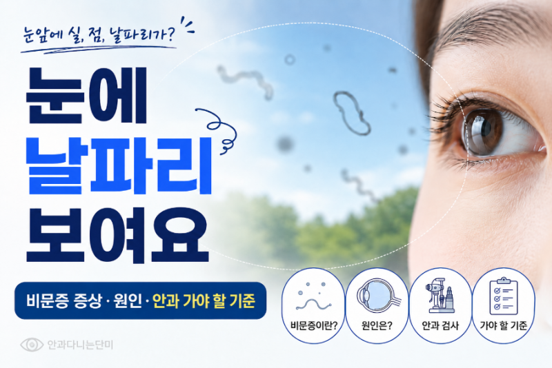눈에 날파리 같은게 보여요 | 비문증 증상과 안과 가야 하는 기준