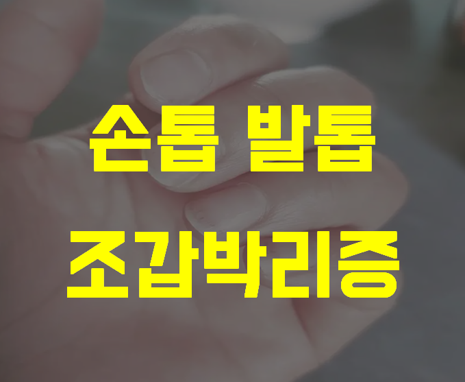 손톱 발톱 조갑박리증이 생기는 원인과 해결 방법
