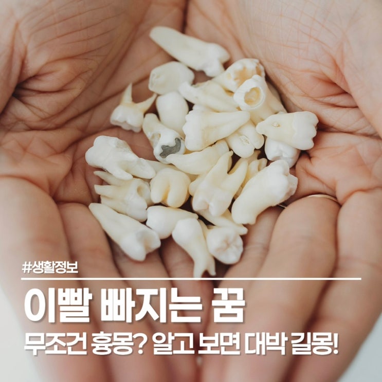  생생했던 이빨 빠지는 꿈, 길몽 vs 흉몽