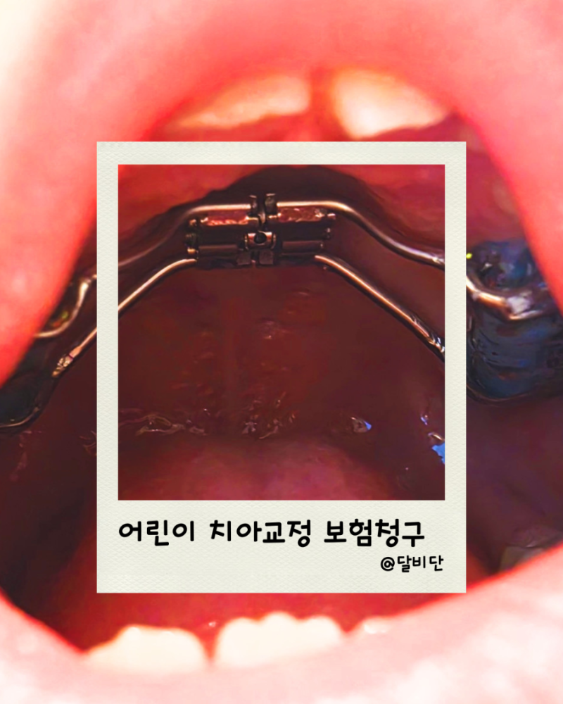 어린이 부정교합 치아교정 시작 ｜현대해상 어린이보험 부정교합 교정비 청구 후기