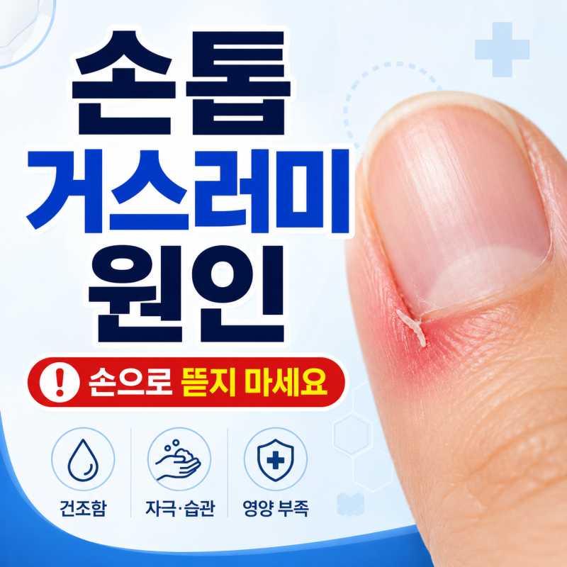 손톱 거스러미 원인, 절대 손으로 잡아 뜯으면 안 되는 이유
