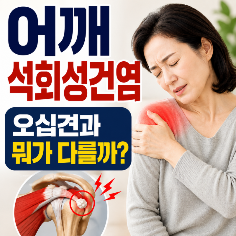 ♀️어깨석회성건염 증상·원인·치료방법 총정리, 오십견과 차이점은?