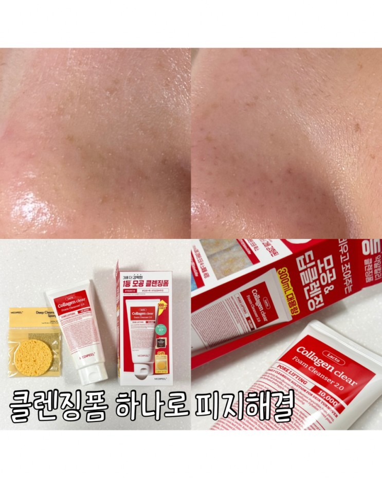  메디필 레드 락토 콜라겐 클리어 폼 클렌저 2.0 여름 피지 잡는 메디필클렌징폼 후기