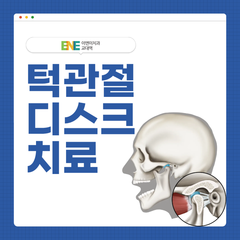 턱관절 디스크 치료 미루다 안면 비대칭까지?
