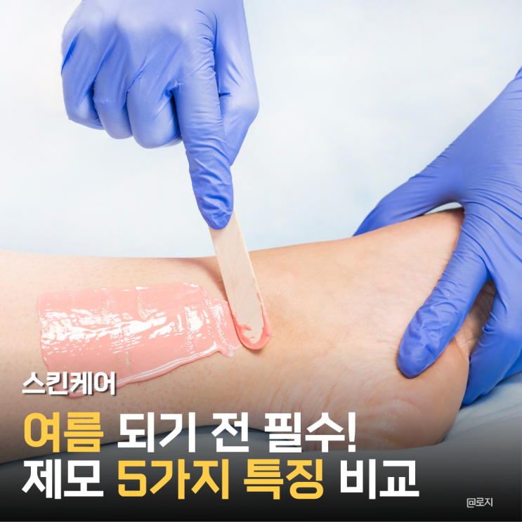  "여름 되기 전 필수! 제모 종류 5가지 특징 비교"