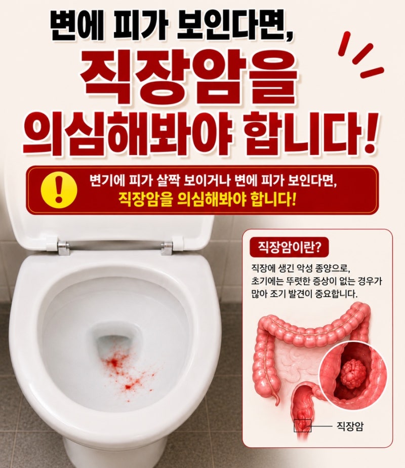 변에 피가 보인다고요? 직장암 증상 3기 4기 말기 전이와 생존율 총정리