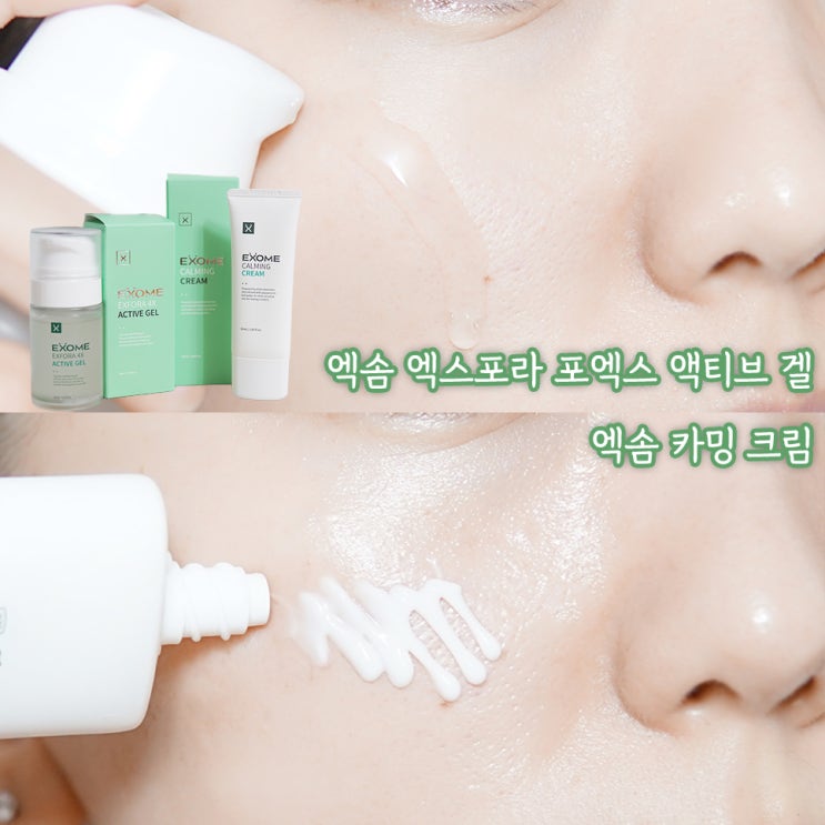  피부결 관리 루틴 추천, 엑솜 카밍 크림 & 엑솜 엑스포라 포엑스 액티브 겔 후기