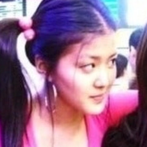 "얼굴 고치는데 5000만원?" 의사들이 인정한 '성형 대박' 난 여배우