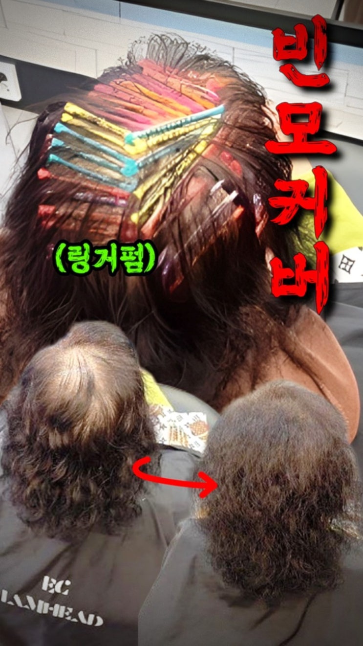  인천정수리탈모 때문에 수원까지 오신 60대 고객님, 뽀글펌으로도 안 되던 정수리 볼륨 해결 후기