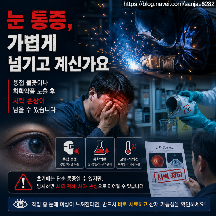  용접공·도장공 안구 화상 산재, 장해급여 받을 수 있을까?