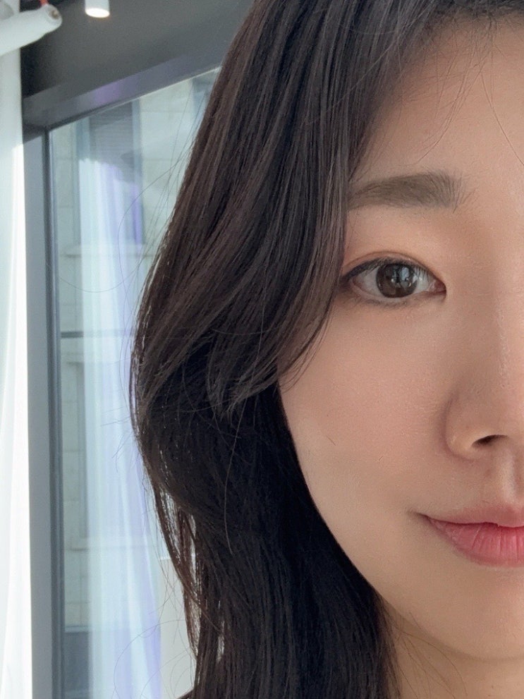 포텐자 효과 7회차 찐후기:) 모공, 트러블 비포 애프터사진 피부기록기