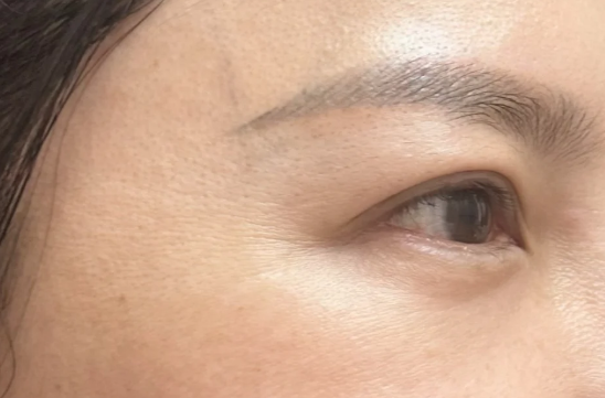  눈가 잔주름 아이크림 효과 본 관리법