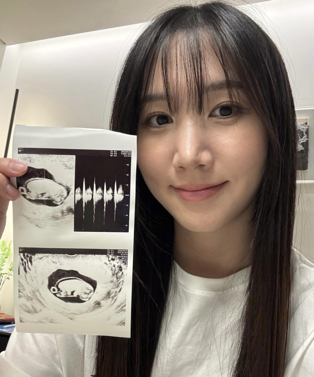'前 에이핑크' <b>홍유경</b>, 결혼 3년 만에 <b>임신</b> "16주차, 태명=당당이"