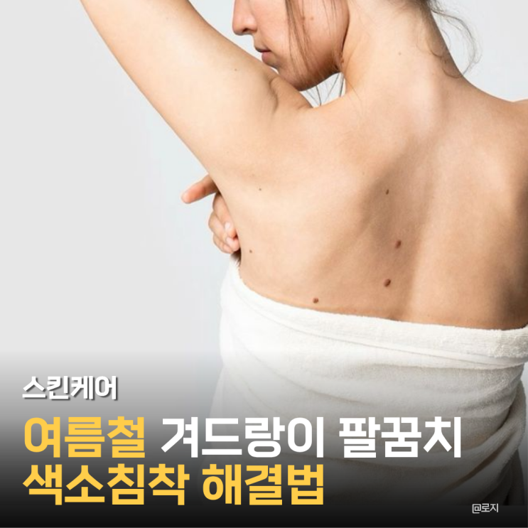  "여름만 되면 거뭇거뭇.. 알고 보니 겨드랑이 색소침착 부르는 최악의 습관은 이거"