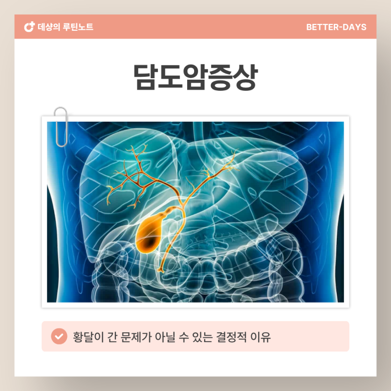 담도암증상 '이 신호' 3가지가 겹치면 황달이 단순 간 문제가 아닙니다