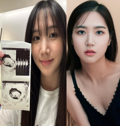 에이핑크 출신 <b>홍유경</b> 결혼 3년차 <b>임신</b> 소식 공개 예비 엄마... 