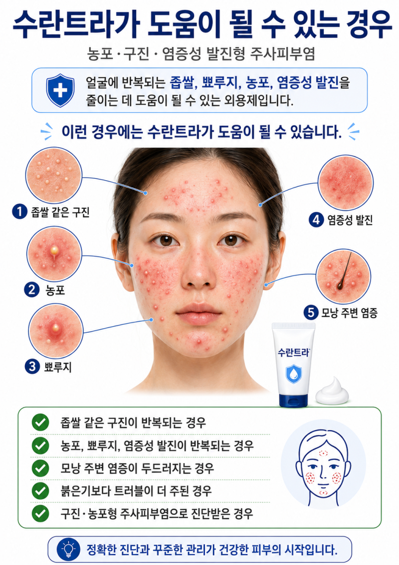주사피부염 수란트라 연고 총정리｜모낭충 검사, 사용법, 중단 기준까지