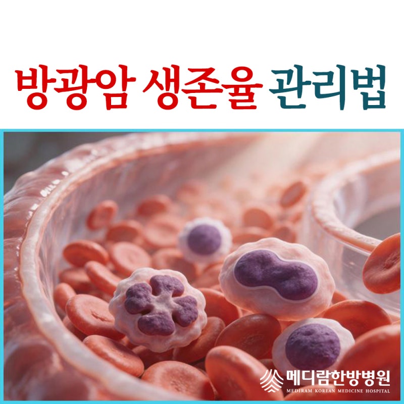 방광암 생존율 1기~4기 치료 총정리