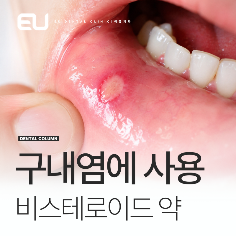 아프니벤큐액, 아프모겐큐 디클로페낙 효능 본격 비교