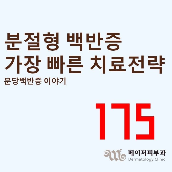 [백반증 이야기-175] 분절형 백반증, 가장 빠른 치료 전략은?SST 수술 + 엑시머레이저 병합요법 ....