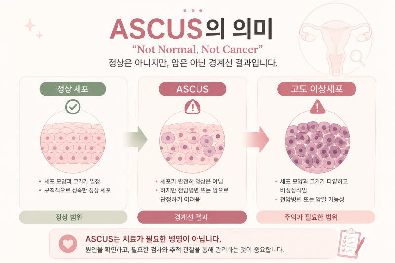 세포검사에서 ASCUS가 나왔어요. 자궁경부암인가요?