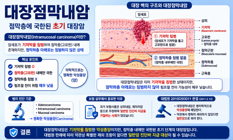 대장점막내암, 암일까 아닐까?