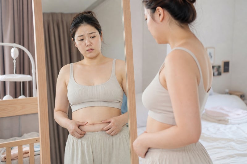 제왕절개 복대 사용 기간과 뱃살 처짐