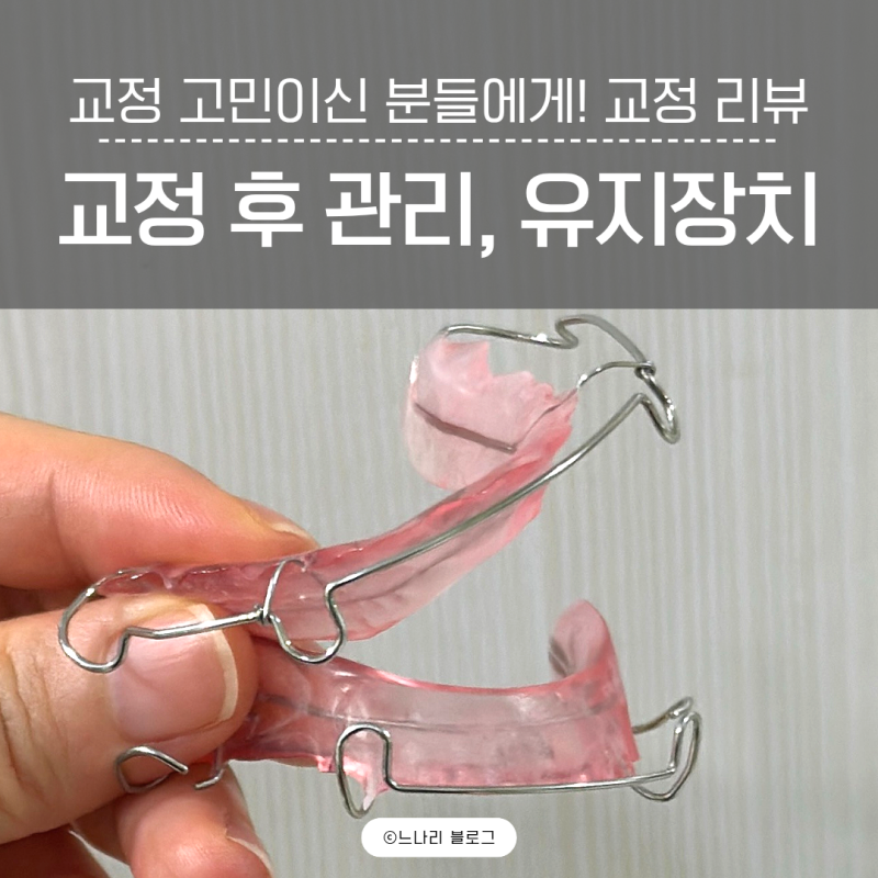드디어 교정기 탈출!! 교정 장치 제거 후 유지장치 관리 사용 방법 등(교정 고민이신 분들에....