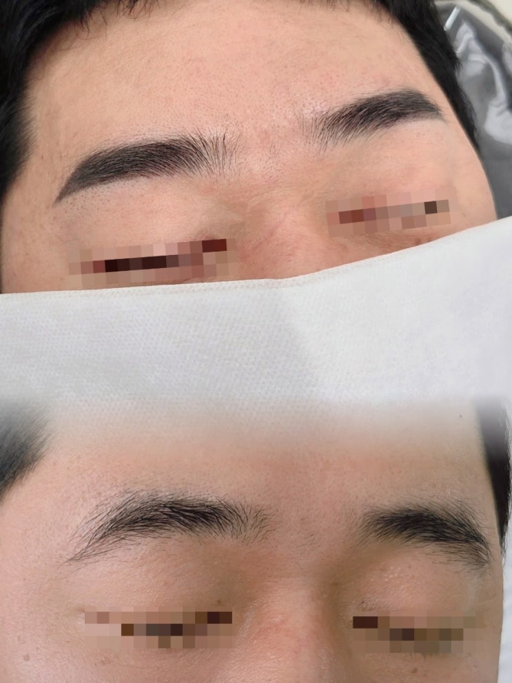  제주 남자눈썹 문신, 부족했던 뒷모 그리고 비대칭 눈썹 해결한 후기