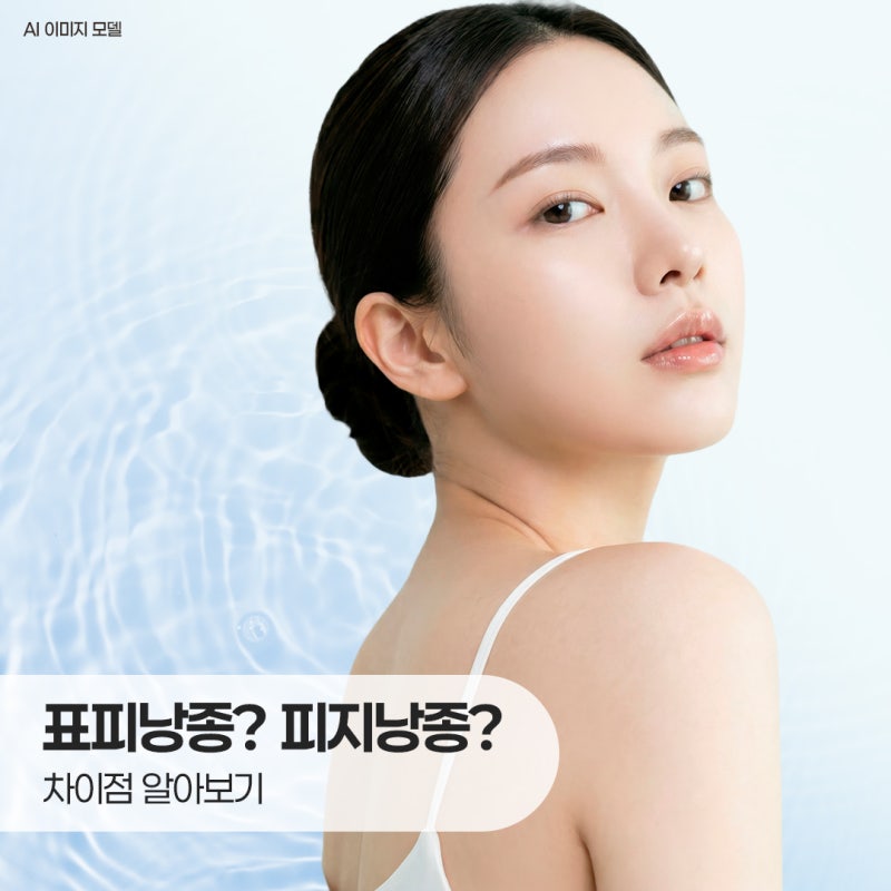 여드름처럼 보이는 창원표피낭종 피지낭종과 차이
