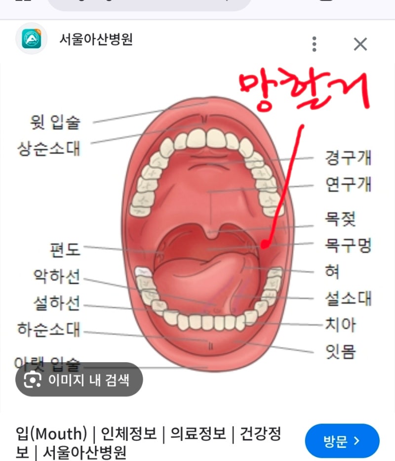 두통 치통에는 게보린이면 구내염에는 무엇이죠