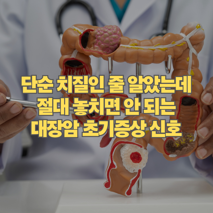  단순 소화불량이나 치질인 줄 알았는데 놓치기 쉬운 대장암 초기증상