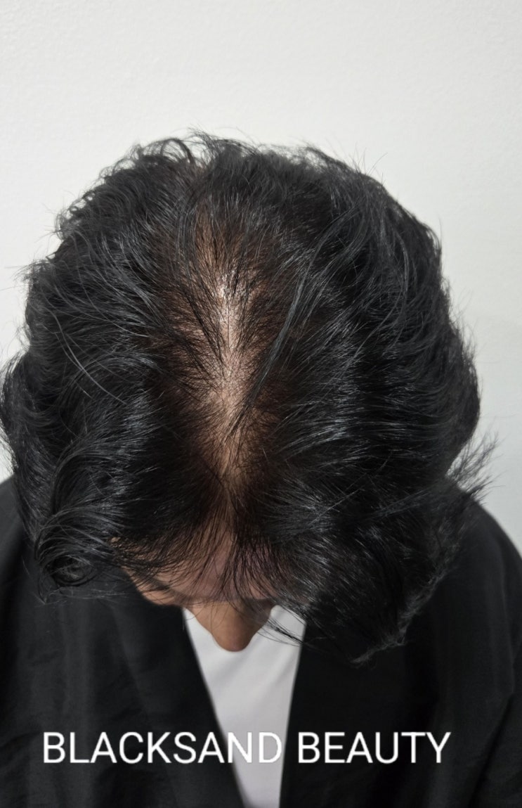  성남두피문신 정수리·가르마가 신경 쓰일 때, 상담에서 자주 오가는 대화
