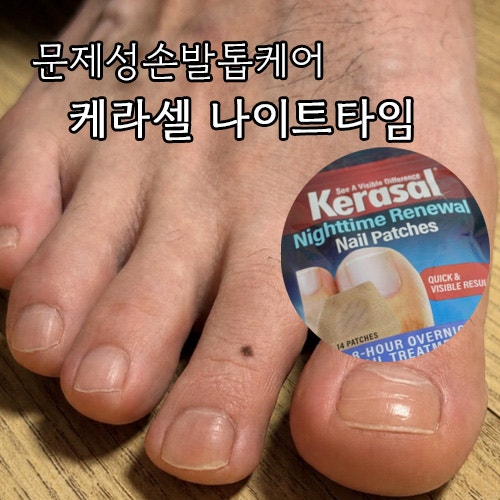 케라셀나이트타임손발톱영양패치 하이드로겔패치 사용후기 문제성손발톱 손발톱집중케어 ....