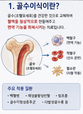 골수이식 비용 얼마일까? 공여자 조건부터 후유증·통증·회복 과정
