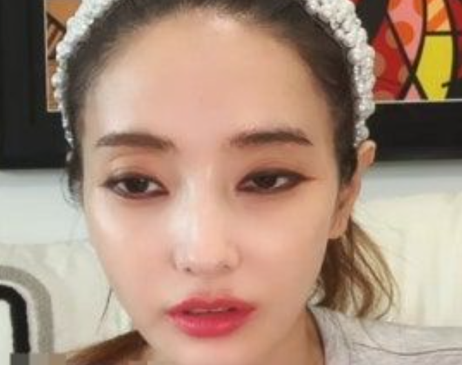 '원조 바비인형'의 필터 수난시대… 한채영을 둘러싼 '눈 풀림' 논란의 반전 진실