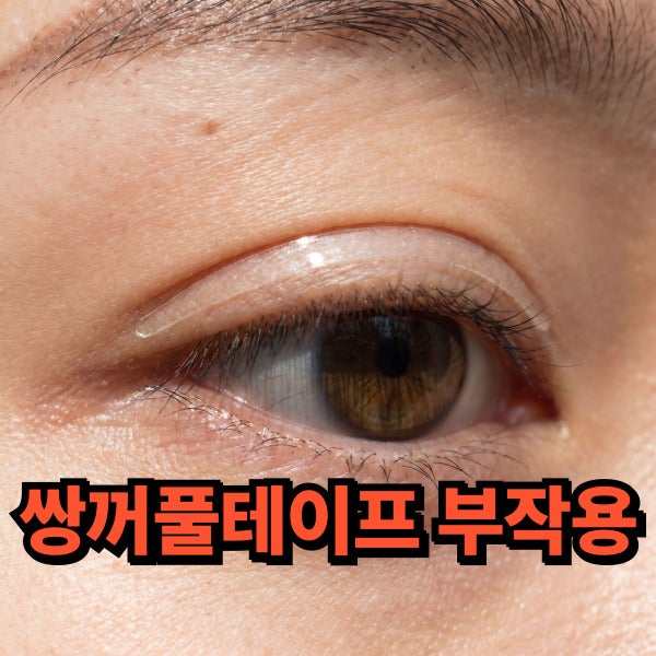 쌍꺼풀테이프 오래 하면 생기는 부작용